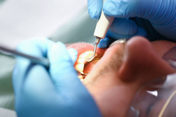 Best Knocked-Out Tooth Emergency  in Greenwood, LA
