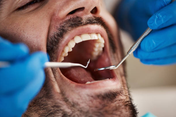 Best Broken Tooth Emergency  in Greenwood, LA