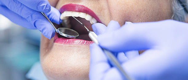 Best Chipped Tooth Repair Near Me  in Greenwood, LA